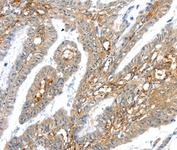 Invitrogen TRIM47 Polyclonal Antibody 100 &mu;L; Unconjugated:Antibodies,