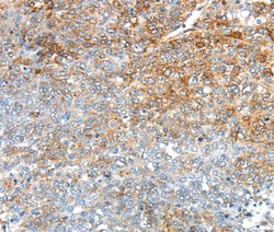 Invitrogen TRIM47 Polyclonal Antibody 100 &mu;L; Unconjugated:Antibodies,