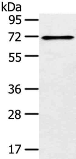 Invitrogen TRIM47 Polyclonal Antibody 100 &mu;L; Unconjugated:Antibodies,