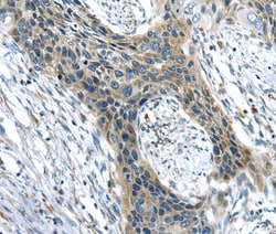 Invitrogen CHRDL1 Polyclonal Antibody 100 &mu;L; Unconjugated:Antibodies,