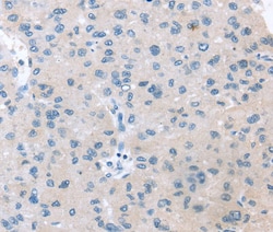 Invitrogen VPS4B Polyclonal Antibody 100 &mu;L; Unconjugated:Antibodies,