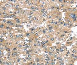 Invitrogen BRWD1 Polyclonal Antibody 100 &mu;L; Unconjugated:Antibodies,