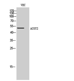 Invitrogen ACOT2 Polyclonal Antibody 100 &mu;L | Buy Online | Invitrogen&trade; | Fisher Scientific