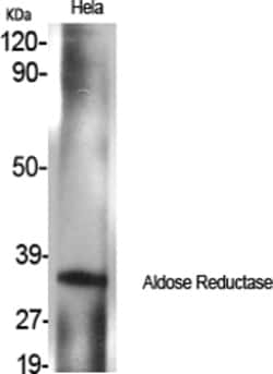 Invitrogen AKR1B1 Polyclonal Antibody 100 &mu;L; Unconjugated:Antikörper