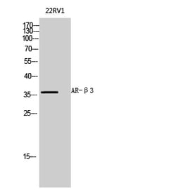 Invitrogen beta-3 Adrenergic Receptor Polyclonal Antibody 100 &mu;L; Unconjugated:Antibodies,
