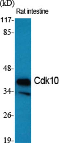 Invitrogen CDK10 Polyclonal Antibody 100 &mu;L | Buy Online | Invitrogen&trade; | Fisher Scientific