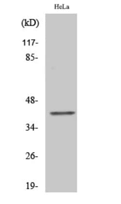 Invitrogen CMKLR1 Polyclonal Antibody 100 &mu;L | Buy Online | Invitrogen&trade; | Fisher Scientific