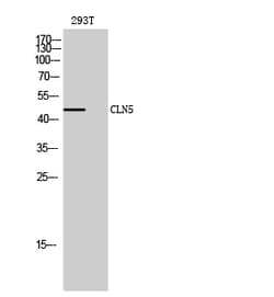 Invitrogen CLN5 Polyclonal Antibody 100 &mu;L; Unconjugated:Anticuerpos