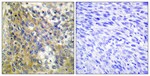 COL4A6 Polyclonal Antibody, Invitrogen™