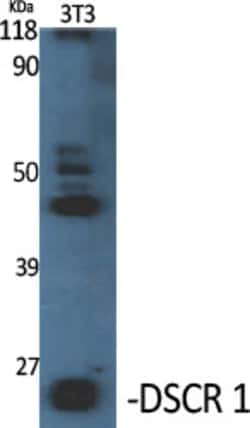 Invitrogen RCAN1 Polyclonal Antibody 100 &mu;L; Unconjugated:Antibodies,