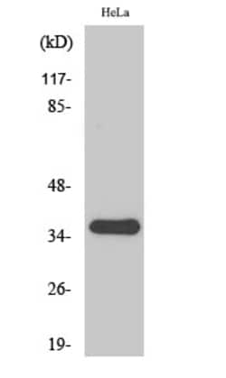 Invitrogen SFRP2 Polyclonal Antibody 100 &mu;L | Buy Online | Invitrogen&trade; | Fisher Scientific