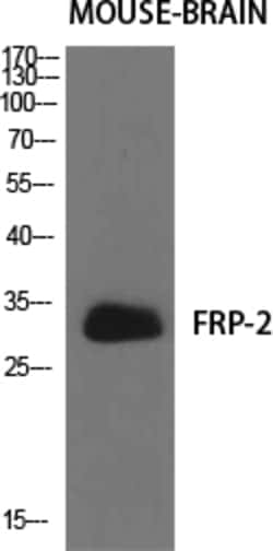 Invitrogen SFRP2 Polyclonal Antibody 100 &mu;L | Buy Online | Invitrogen&trade; | Fisher Scientific