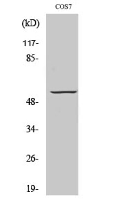 Invitrogen GPR101 Polyclonal Antibody 100 &mu;L | Buy Online | Invitrogen&trade; | Fisher Scientific
