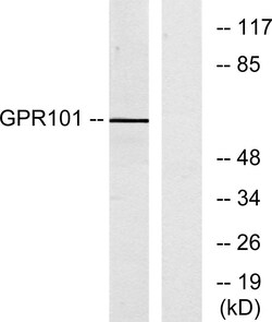 Invitrogen GPR101 Polyclonal Antibody 100 &mu;L | Buy Online | Invitrogen&trade; | Fisher Scientific