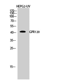 Invitrogen GPR120 Polyclonal Antibody 100 &mu;L; Unconjugated:Antibodies,