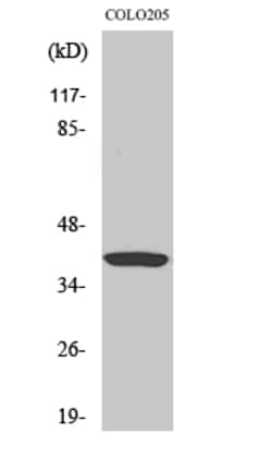 Invitrogen GNAT1 Polyclonal Antibody 100 &mu;L; Unconjugated:Antibodies,