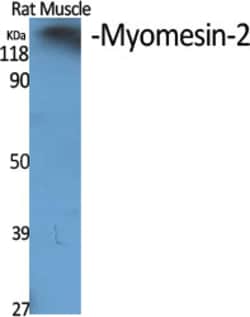 Invitrogen MYOM2 Polyclonal Antibody 100 &mu;L; Unconjugated:Antibodies,