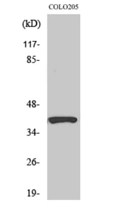 Invitrogen SERPINB9 Polyclonal Antibody 100 &mu;L; Unconjugated:Antibodies,