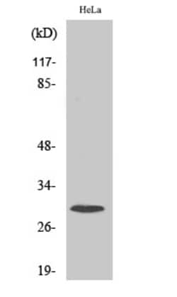 Invitrogen RPS4X Polyclonal Antibody 100 &mu;L; Unconjugated:Antibodies,