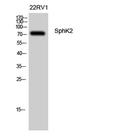 Invitrogen SPHK2 Polyclonal Antibody 100 &mu;L | Buy Online | Invitrogen&trade; | Fisher Scientific