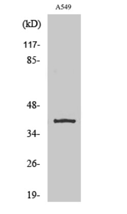 Invitrogen KCNK15 Polyclonal Antibody 100 &mu;L | Buy Online | Invitrogen&trade; | Fisher Scientific