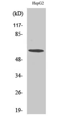 Invitrogen TCP-1 zeta Polyclonal Antibody 100 &mu;L; Unconjugated:Antibodies,