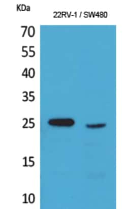 Invitrogen SSX1 Polyclonal Antibody 100 &mu;L; Unconjugated:Antibodies,