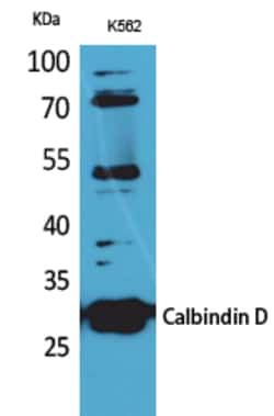 Invitrogen Calbindin D28K Polyclonal Antibody 100 &mu;L; Unconjugated:Anticorps,