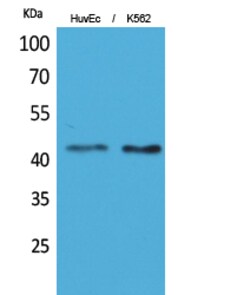 Invitrogen Layilin Polyclonal Antibody 100 &mu;L | Buy Online | Invitrogen&trade; | Fisher Scientific