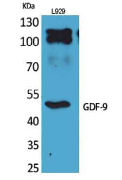 Invitrogen GDF9 Polyclonal Antibody 100 &mu;L | Buy Online | Invitrogen&trade; | Fisher Scientific