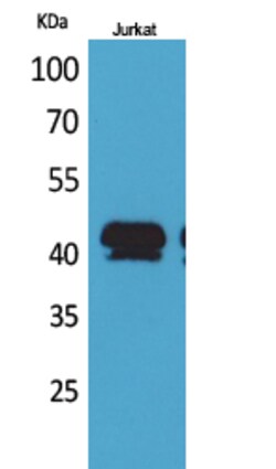 Invitrogen BMP-8A Polyclonal Antibody 100 &mu;L; Unconjugated:Antibodies,
