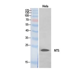 Invitrogen NTS Polyclonal Antibody 100 &mu;L | Buy Online | Invitrogen&trade; | Fisher Scientific