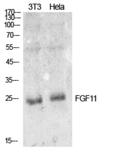 Invitrogen FGF11 Polyclonal Antibody 100 &mu;L | Buy Online | Invitrogen&trade; | Fisher Scientific