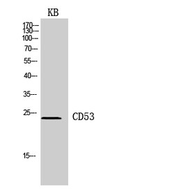 Invitrogen CD53 Polyclonal Antibody 100 &mu;L; Unconjugated:Antibodies,