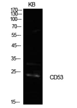 Invitrogen CD53 Polyclonal Antibody 100 &mu;L; Unconjugated:Antibodies,