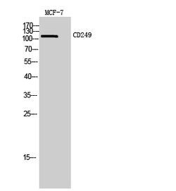 Invitrogen CD249 Polyclonal Antibody 100 &mu;L | Buy Online | Invitrogen&trade; | Fisher Scientific