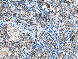 Invitrogen IGF2BP3 Polyclonal Antibody 100 &mu;L; Unconjugated:Antibodies,