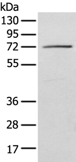 Invitrogen IGF2BP3 Polyclonal Antibody 100 &mu;L | Buy Online | Invitrogen&trade; | Fisher Scientific