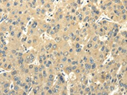 Invitrogen FABP8 Polyclonal Antibody 100 &mu;L; Unconjugated:Antibodies,