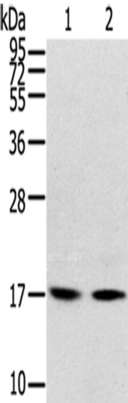 Invitrogen RPLP1 Polyclonal Antibody 100 &mu;L; Unconjugated:Antibodies,