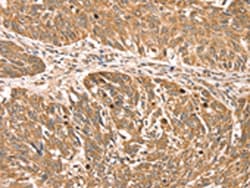 Invitrogen RPLP2 Polyclonal Antibody 100 &mu;L; Unconjugated:Antibodies,