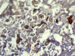 Invitrogen TXNDC11 Polyclonal Antibody 100 &mu;L; Unconjugated:Antibodies,