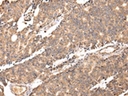 Invitrogen UGGT2 Polyclonal Antibody 100 &mu;L | Buy Online | Invitrogen&trade; | Fisher Scientific