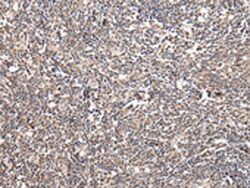 Invitrogen UGGT2 Polyclonal Antibody 100 &mu;L | Buy Online | Invitrogen&trade; | Fisher Scientific