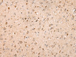 Invitrogen UQCRC2 Polyclonal Antibody 100 &mu;L | Buy Online | Invitrogen&trade; | Fisher Scientific