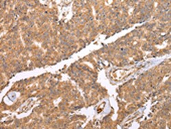 Invitrogen UQCRC2 Polyclonal Antibody 100 &mu;L | Buy Online | Invitrogen&trade; | Fisher Scientific