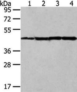 Invitrogen UQCRC2 Polyclonal Antibody 100 &mu;L | Buy Online | Invitrogen&trade; | Fisher Scientific