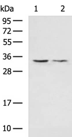 Invitrogen VDAC3 Polyclonal Antibody 100 &mu;L; Unconjugated:Antibodies,