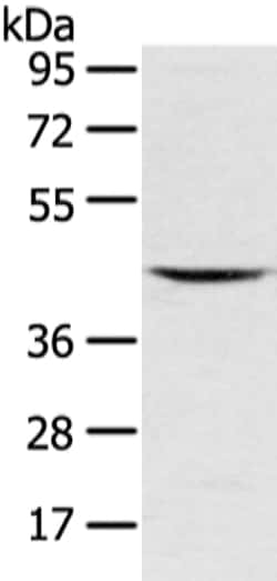 Invitrogen VSIG8 Polyclonal Antibody 100 &mu;L; Unconjugated:Antibodies,