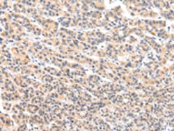 Invitrogen VPS54 Polyclonal Antibody 100 &mu;L | Buy Online | Invitrogen&trade; | Fisher Scientific